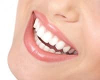 dentista genova denti bianchi