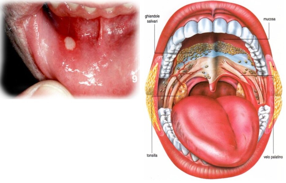 BOCCA DENTISTA GENOVA BOCCA DENTISTA GENOVA