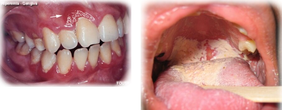 bocca problemi dentista bocca problemi dentista