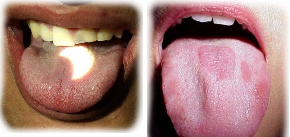 lingua dentista genova lingua dentista genova