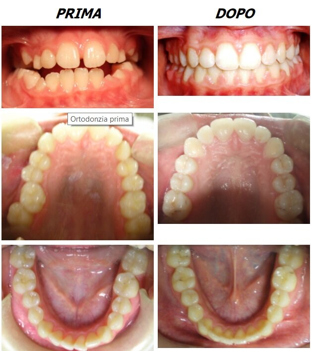 casi ortodonzia