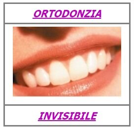 ortodonzia invisibile invisalign