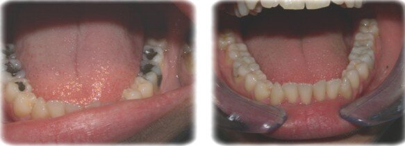 otturazioni dentista genova otturazioni dentista genova