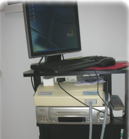 telecamera endorale telecamera endorale