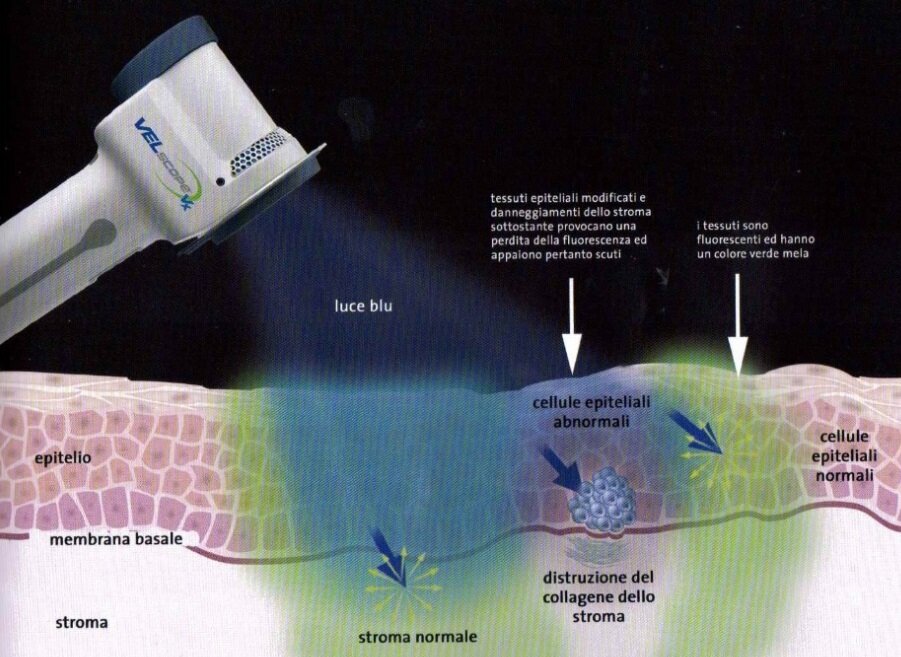 diagnosi tumore bocca dentista diagnosi tumore bocca dentista